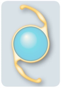 Typical design of an intraocular lens.