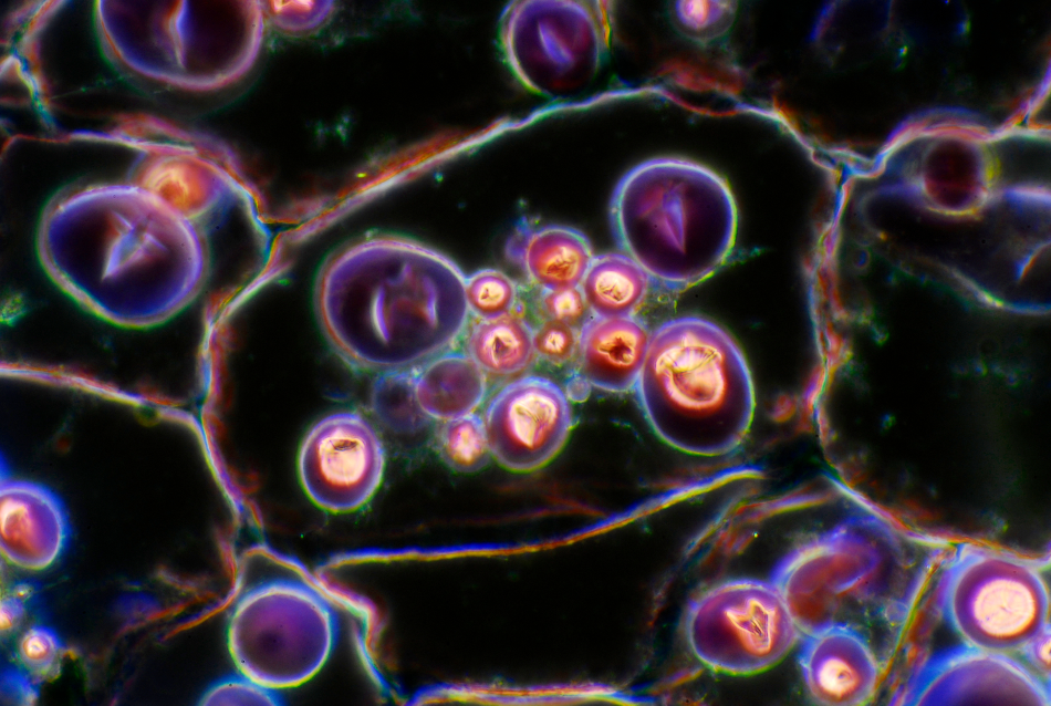 Starch in potato cells under the microscope, magnification 400x, dark field