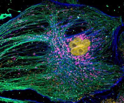 Mammalian cell cytoskeleton. Image acquired with Dragonfly spinning disk confocal microscope using an iXon 888 EMCCD camera.
