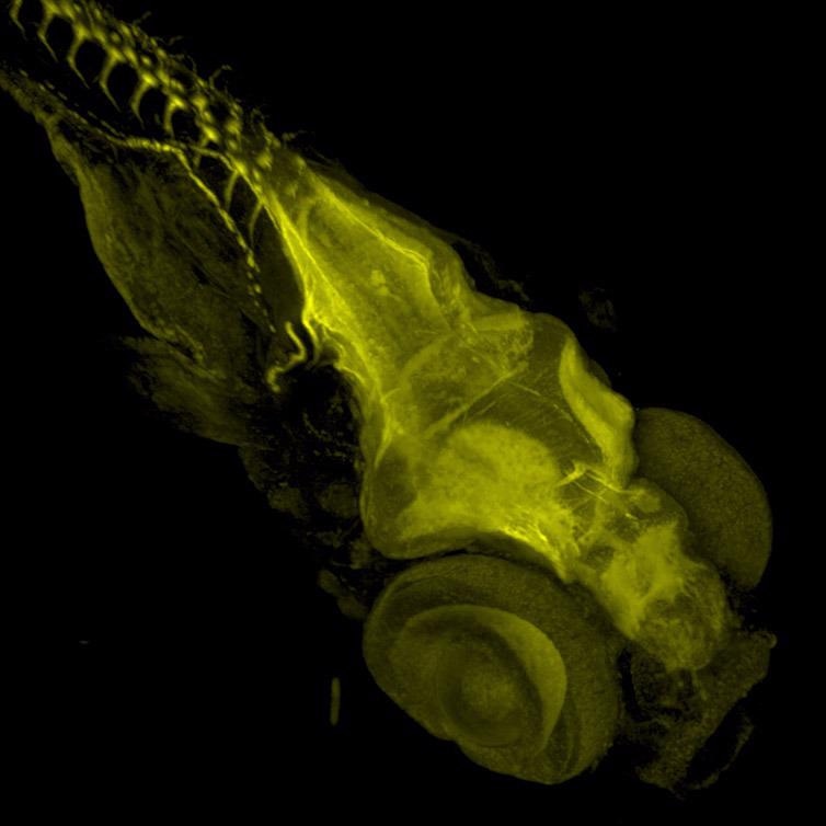 Zebrafish stained with Acetylated Tubulin.  Image acquired with Dragonfly spinning disk microscope using a Sona 4.2B6 sCMOS camera.