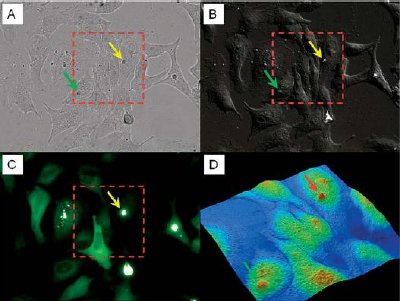 Using AFM to generate additional information to optical microscopy. Mutant YFP-tagged htt protein forms bright aggregates (images A, bright fi eld and B, DIC, image C, epifl uorescence, yellow arrows) that are also easily recognized in the AFM topographic channel (image D, red arrow in). In addition, changes in cell topology caused by other cellular substructures similar to that caused by aggregates could also be detected by the AFM scan (image D, green arrow). Optical images taken with a 20x objective. AFM scan: 90x90x3µm.