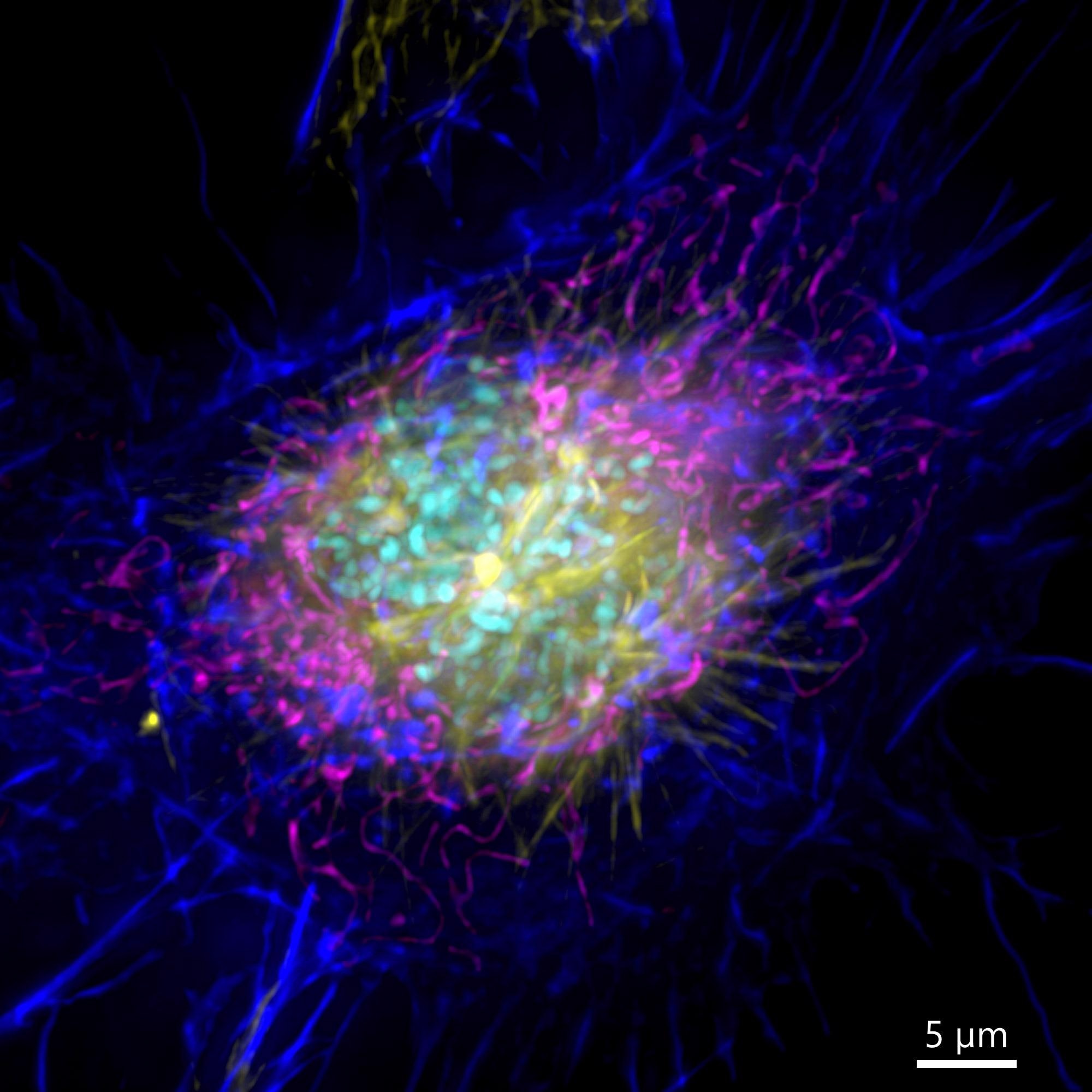 Image of a mammalian cell acquired using widefield modality, using Andor BC43. Image shows the widefield image of a prophase cell ll. Image was further deconvolved after acquisition and is a Maximum intensity projection of 35 Stacks over a 7 µm range. Dark blue-actin, magenta-mitochondria, yellow-microtubules, Cyan-DNA.