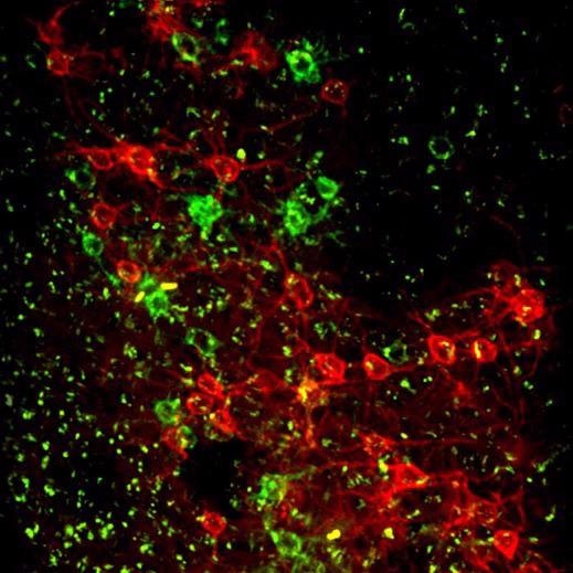 Coronal slice, mouse cortex. Histology of a mouse used for in vivo voltage imaging using Ace-mNeonGreen and Varnam (red) labeled neurons. Both fluorophores express in the cell membrane. Laser source: Fluence Halite (rep. rate 20 MHz, wavelength 1030 nm)