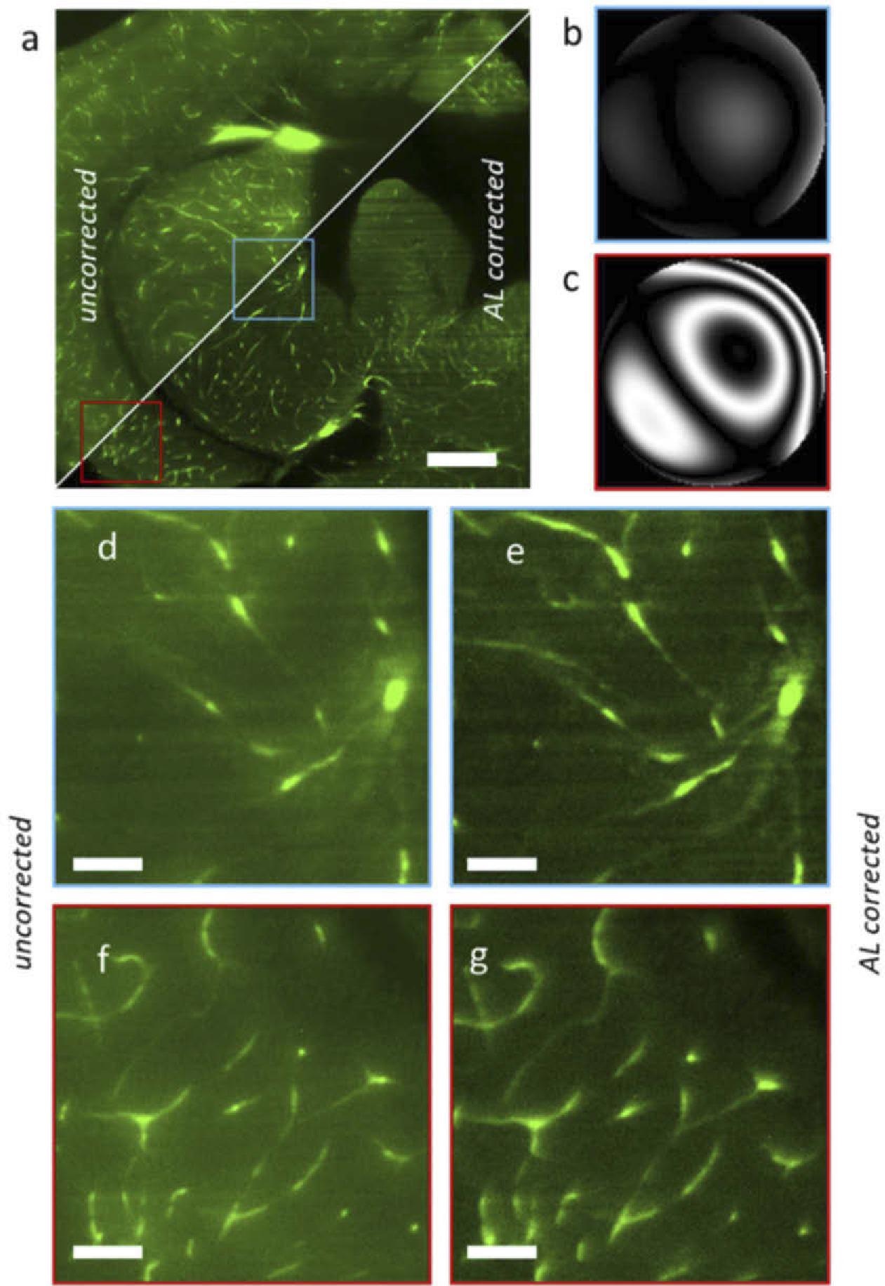 Light sheet microscopy acquisition of a chemically cleared adult zebrafish brain section, without and with AL correction. (a) Full image uncorrected (top-left triangle) vs corrected with the adaptive lens (bottom-right). (b) Wavefront aberration in the central region (blue in panel a). (c) Wavefront aberration at the left-bottom concern (red). (d-g) Magnified regions uncorrected (d, f) and corrected with the adaptive lens (e, g). Scalebar is 200 µm in a and 40 µm in b.