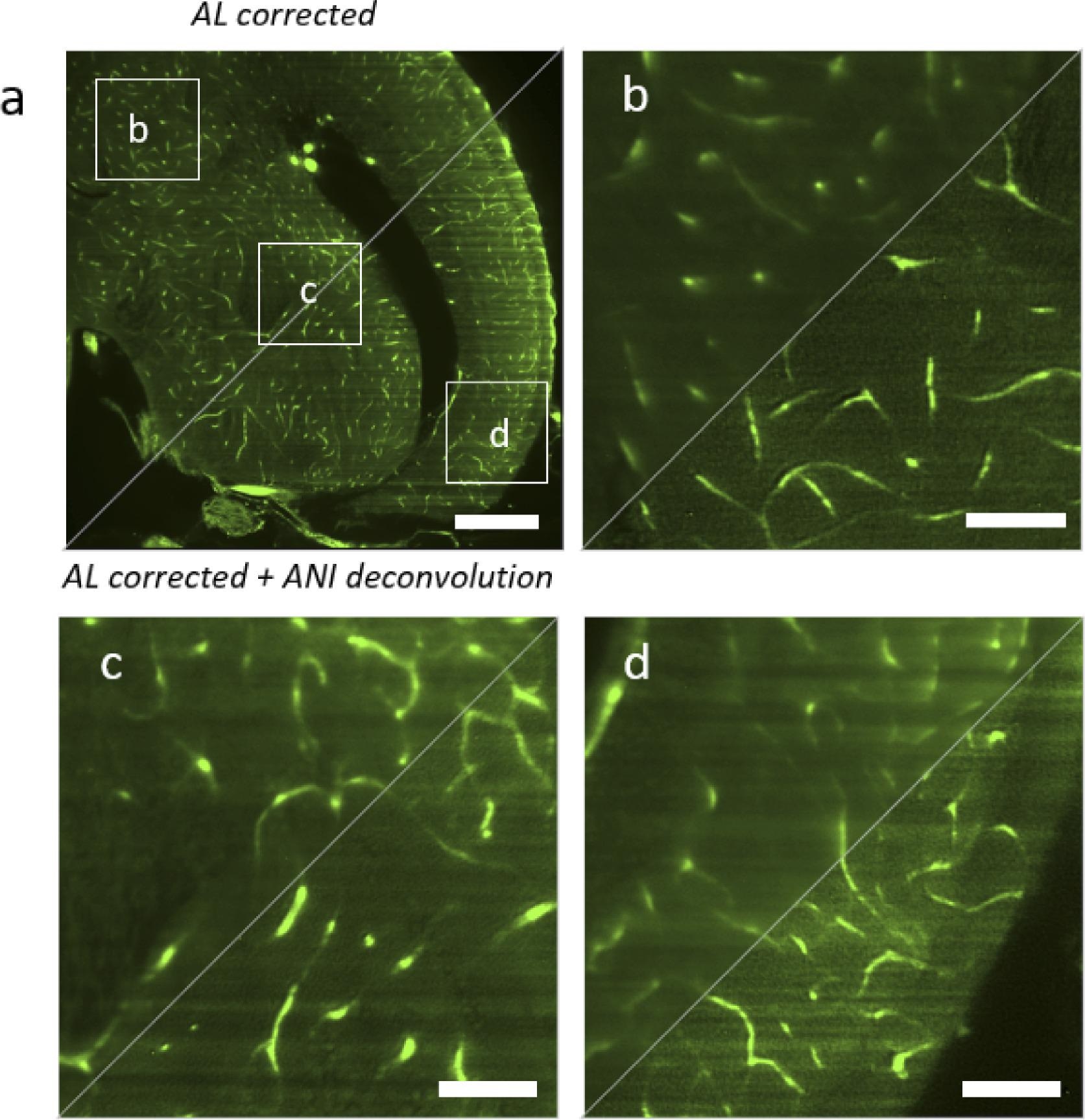 Comparison between hardware correction with adaptive lens (AL) and the combination of hardware correction with anisoplanatic deconvolution (ANI). AL corrected is shown in the top left triangles, AL corrected with ANI deconvolution is shown in the bottom right triangle. (a) Full image of a zebrafish brain plane (b) Magnified region in the top left corner. (c) Magnified region in the center. (d) Magnified region in the bottom right corner. Scalebar is 200 µm in a and 50 µm in b–d.