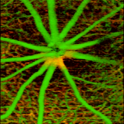 OCT angiography image of mouse retina shows both large and micro-vessels at different depth locations using intrinsic contrast only. The false color in the image encodes the depth location of the blood vessels. Image taken with an OCT system built using a Cobra 800 spectrometer.