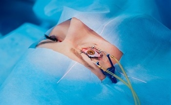 Using Lasers in Surgery