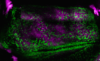 Multiphoton Microscopy: Imaging Brains of Mice on the Go