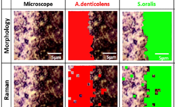 Using Confocal Raman Microscopy to Map Oral Biofilms