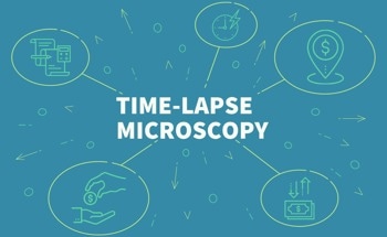 Time-Lapse Microscopy in Cell Biology
