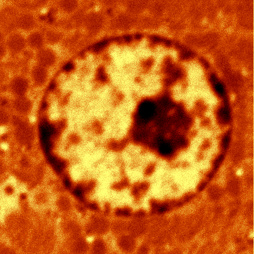 Super-resolution SNOM image of the nucleus of a rat hepatocyte.