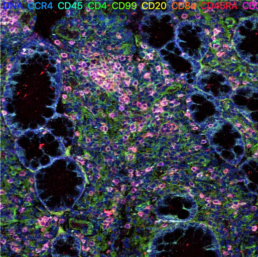 Novel Imaging Technology Used to Map Cells of Inflammatory Bowel Disease.