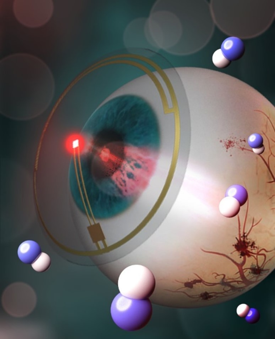 Early Treatment System for Diabetic Retinopathy Using Smart LED Contact Lenses