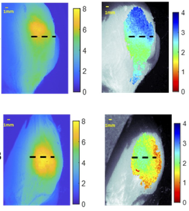 Enhanced Tumor Depth Information Using Fluorescence Imaging System