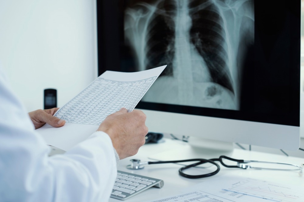 AI-Assisted Terahertz Imaging for Acute Lung Injury Therapy