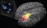Hand-Held Raman Spectroscopy Intraoperative Probe to Detect Invasive Brain Cancer Cells