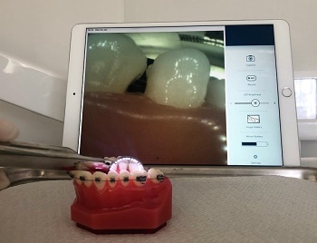 Ultrabright SMARTmirror Provides Real-Time Images and Video  to Dentists and Patients During Dental Procedures