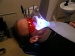 UV Light-Enhanced Tooth Bleaching Not Only a Con, but Dangerous to Your Eyes and Skin