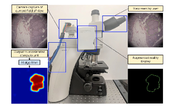 Google Healthcare Relies on BitFlow CoaXPress Frame Grabber for Augmented Reality Microscope