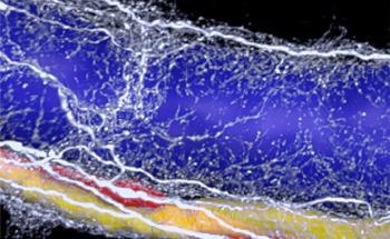 3D Imaging Shows Degeneration of Nerves is Correlated with Liver Pathology Severity