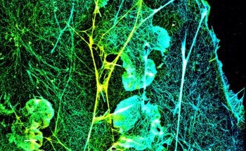 Biotium and UC Berkeley Announce New Study Offering Strategy for Designing Fluorescent Dyes for Super-resolution Imaging