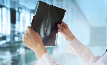 Researchers Propose Promising Non-Invasive Breast Tumor Imaging