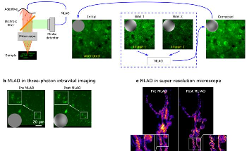 Universal Adaptive Optics for Microscopy with Embedded Neural Networks