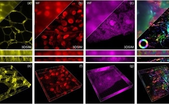 Microscopy Breakthrough for High-Speed Imaging